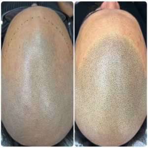 1C462B3D-5B07-4631-906A-679A88BDB3DE (2)