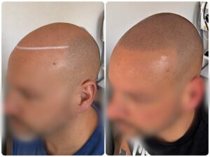micropigmentation effet rasé Sainte genevieve des bois